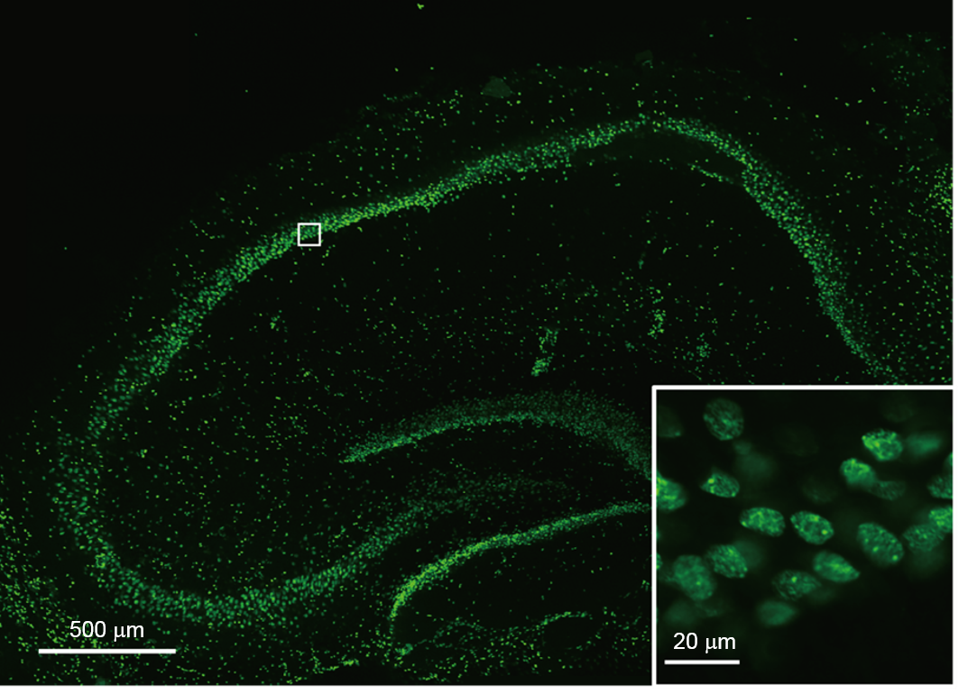 NucleoSeeingを用いたマウス脳（海馬）スライス培養組織の染色例