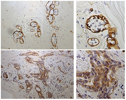 Fig.4 IHC image of tissues in clone P2H