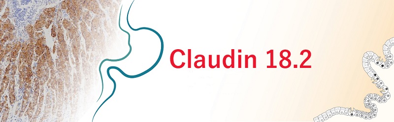 Claudin 18.2と胃がん