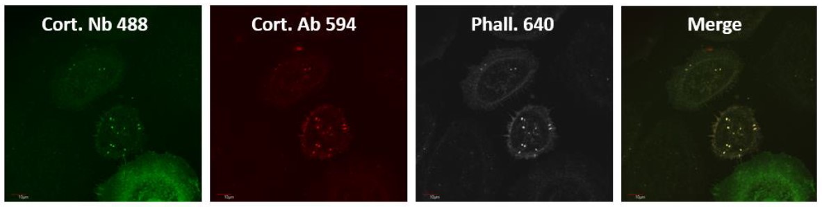 抗Cortactin SH3抗体を用いたHeLa細胞の染色像