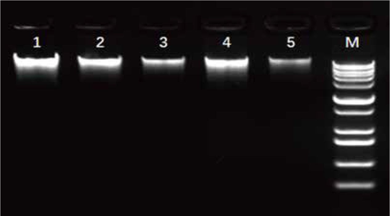 SPINeasy-DNA-Kit-for-Soil-Purified-Genomic-DNA