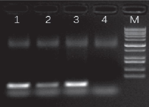 SPINeasy-DNA-Kit-for-Feces-12S-rRNA-Gene-PCR