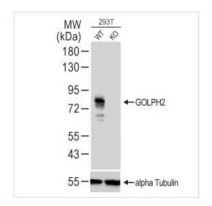 GOLPH2 antibody (#GTX107702)のWB