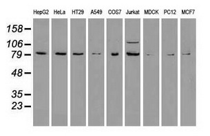 B-Raf antibody (#GTX84812)のWB