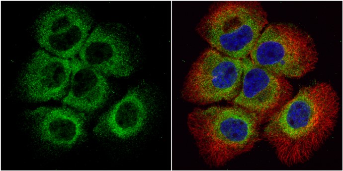 Anti-Bid Antibody [N1C3-2]（#GTX110568）を用いた免疫蛍光染色像