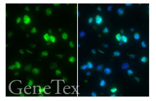 SARS-CoV-2 (COVID-19) Envelope FFPE Cell Pellet Block (#GTX435642) 