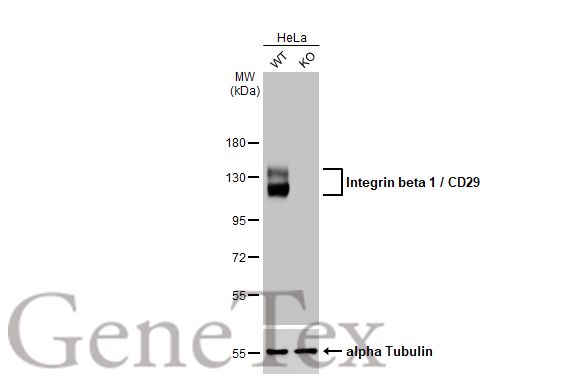 抗インテグリンβ1抗体（クローン：HL1255）（#GTX636657）のウエスタンブロット解析