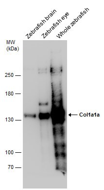 Anti-Col1a1a antibody（#GTX133063）