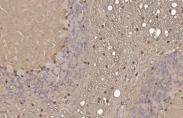 図2. 免疫組織染色像
