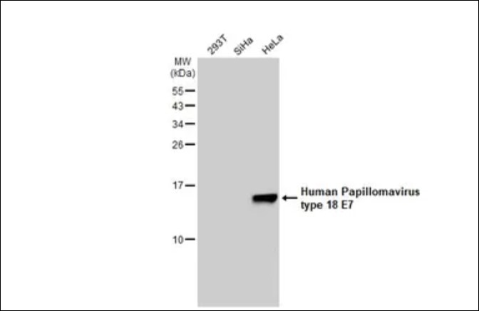 Human Papillomavirus type 18 E7 antibody [GT881] 