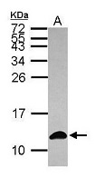 Melanoma Marker（メラノーママーカー）抗体 GTX121460を使用したWB画像