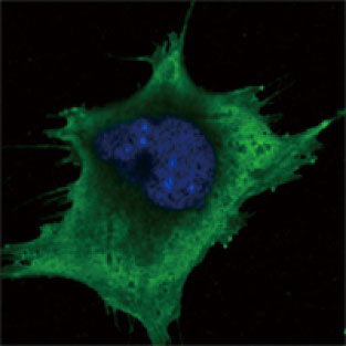 抗SOD1抗体を用いた3T3-L1細胞の蛍光免疫染色像