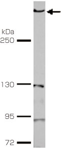 DNA脱メチル化関連タンパク質TET1に対する抗体 抗TET1抗体(TET1 antibody)
