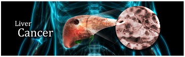 肝臓がん研究用抗体