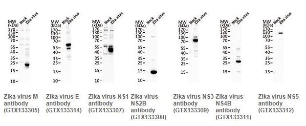 抗ジカウイルス（Zika virus）抗体の使用例