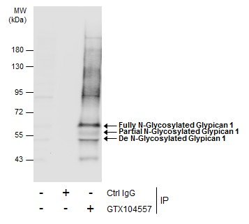 Glypican-1抗体 IP