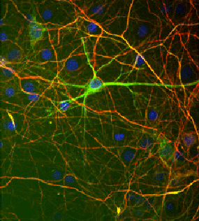 培養神経細胞およびグリア細胞の免疫染色像
