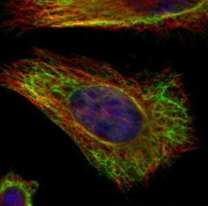 メタノール固定HeLa細胞の免疫染色像