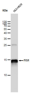 抗FIS1抗体の使用例