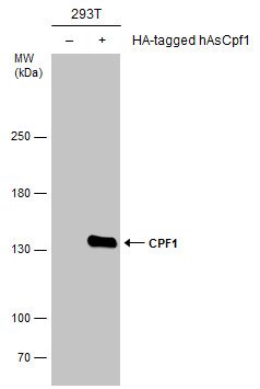 抗Cpf1抗体を用いたウエスタンブロッティング像