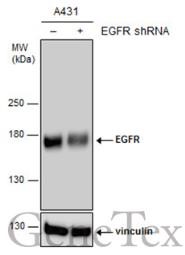 抗EGFR抗体（#GTX628887）を用いたウエスタンブロット像
