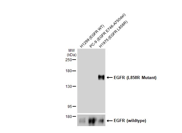 抗EGFR（L858R変異体）特異的抗体