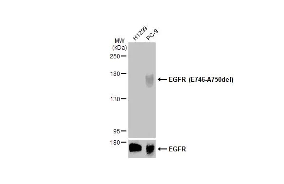 抗EGFR（Glu746-Ala750欠損変異体）特異的抗体