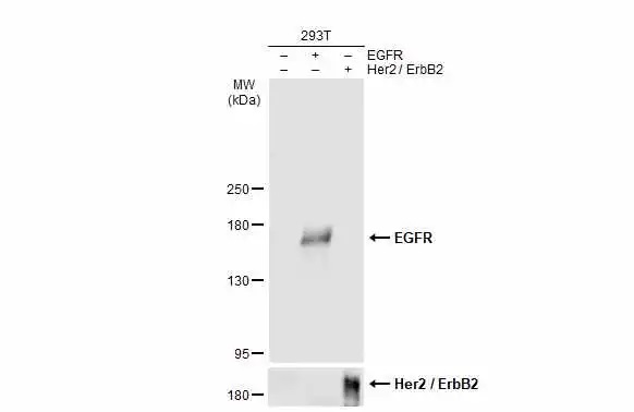 抗EGFR抗体