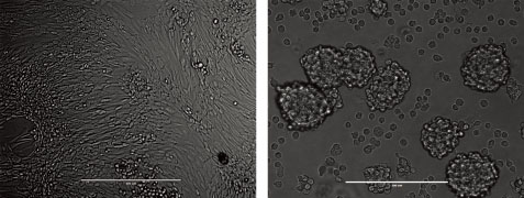 CHO-K1細胞を通常の二次元培養（左）および本製品（右）を用いて培養した。