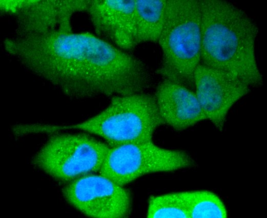 #ET1610-93を用いた免疫細胞染色像