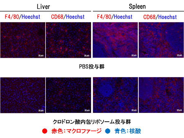 正常マウスにおける肝臓・脾臓のマクロファージの組織免疫染色