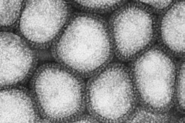 インフルエンザウイルスB型の電子顕微鏡写真