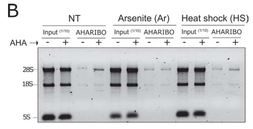 IBT-68157-13-AHARIBO-Total-RNA-Analysis