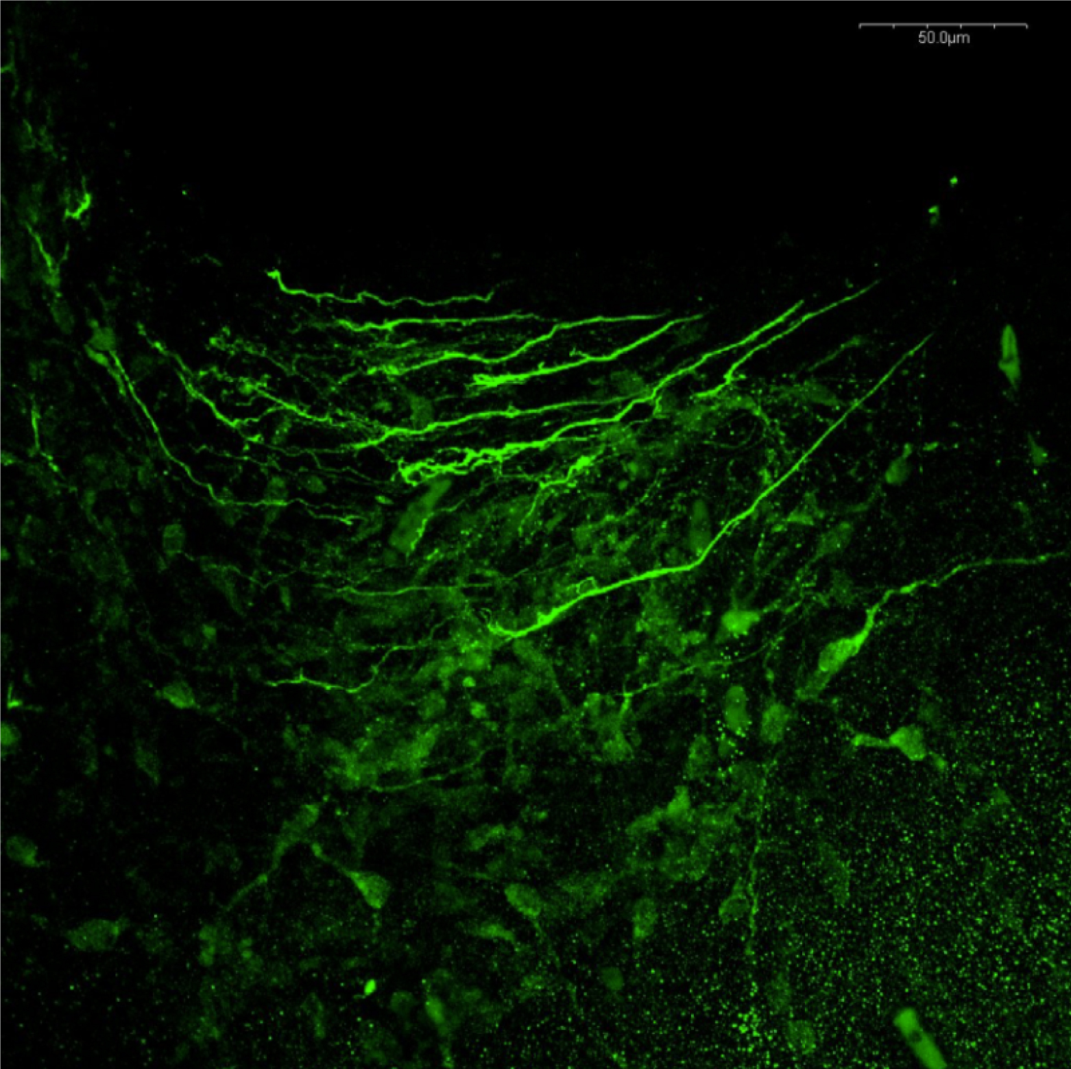 マウスE13.5胚の中脳ニューロンにおける免疫蛍光染色によるドーパミン局在の確認
