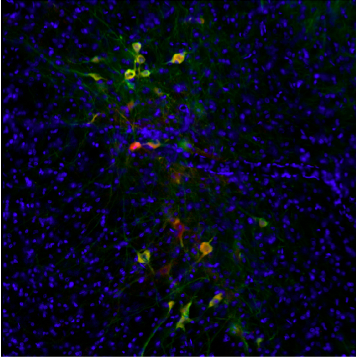 ラット脳冠状切片の黒質緻密部（SNc）におけるドーパミン作動性ニューロンの免疫蛍光染色