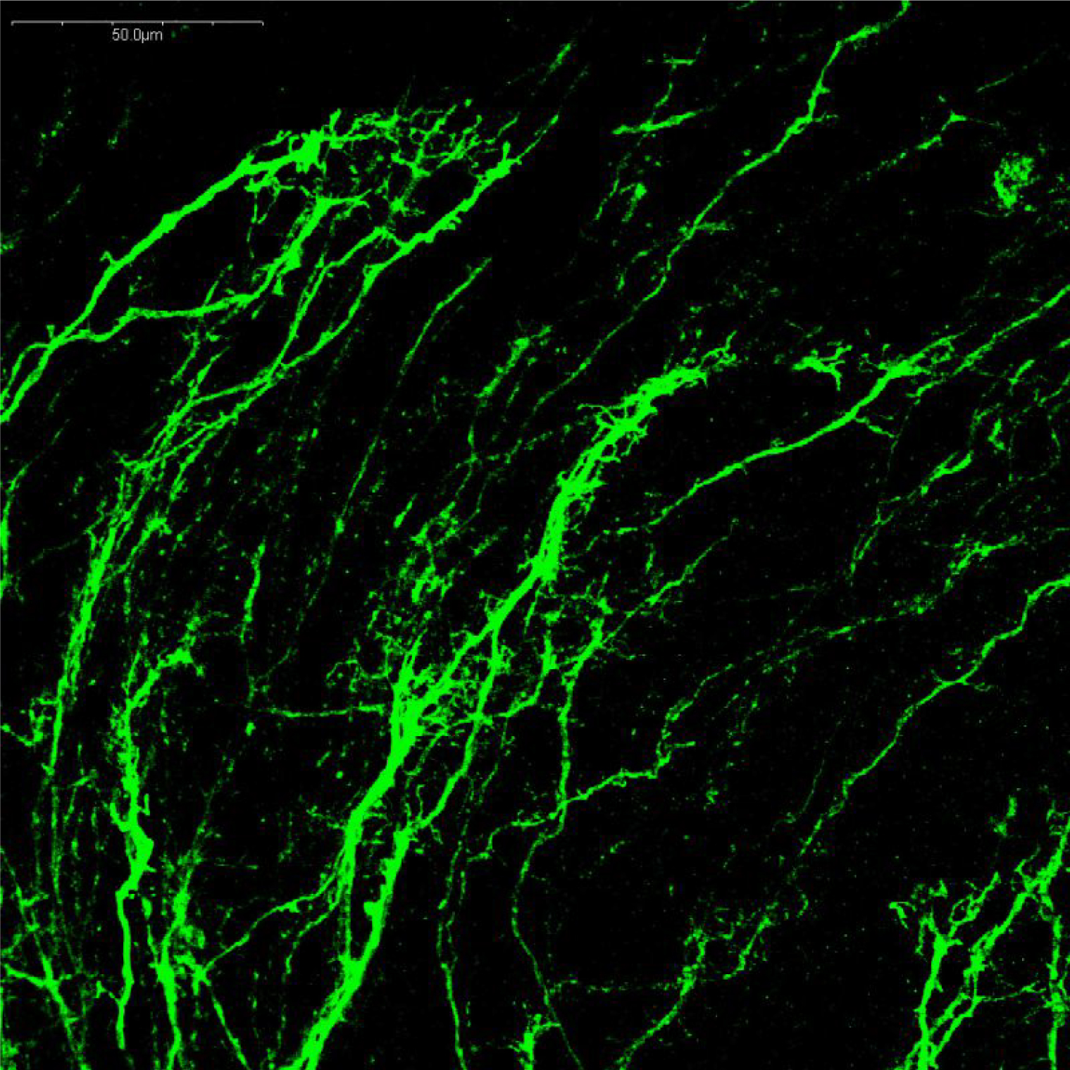 マウスE13.5胚の脳幹におけるドーパミン作動性ニューロンの免疫蛍光染色像