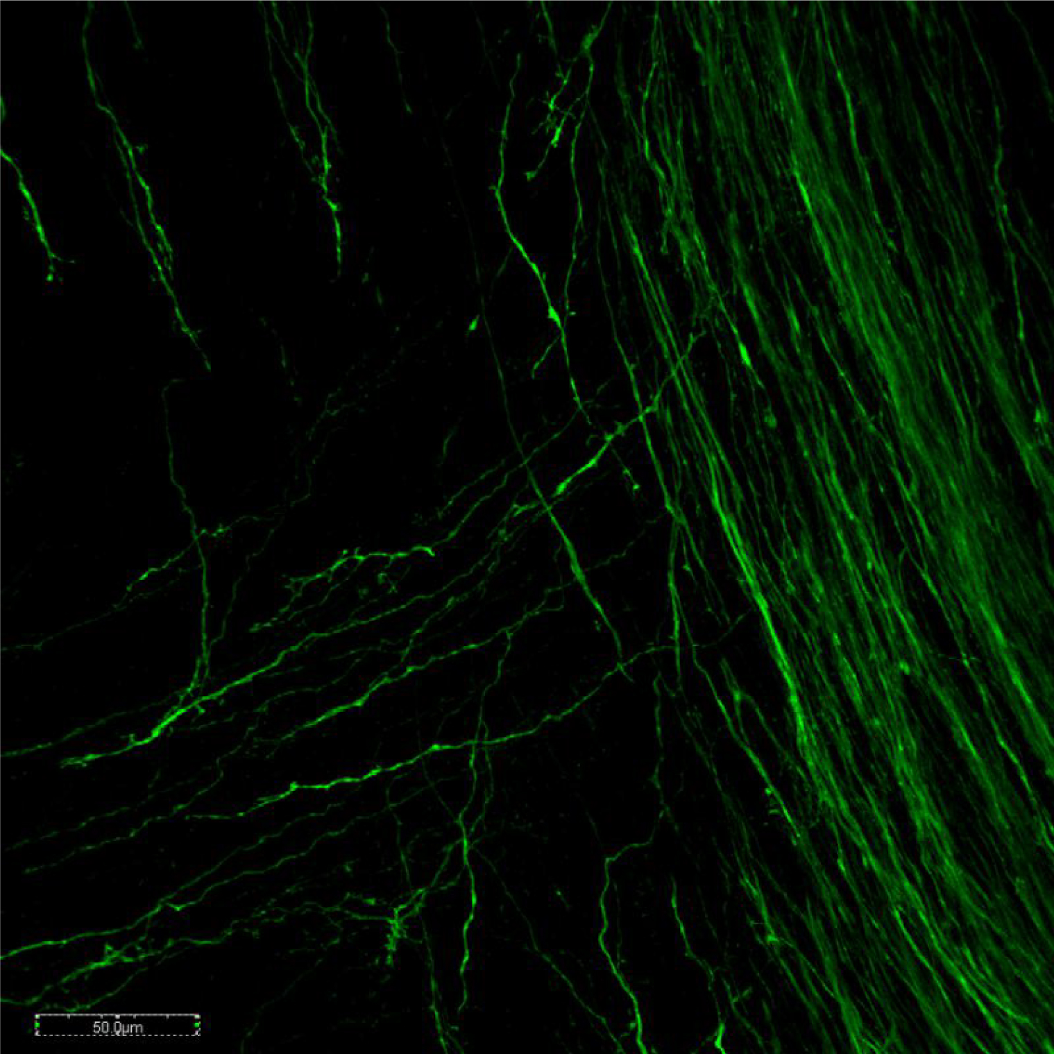 マウスE13.5胚の脳幹におけるドーパミン作動性ニューロン線維の免疫蛍光染色像