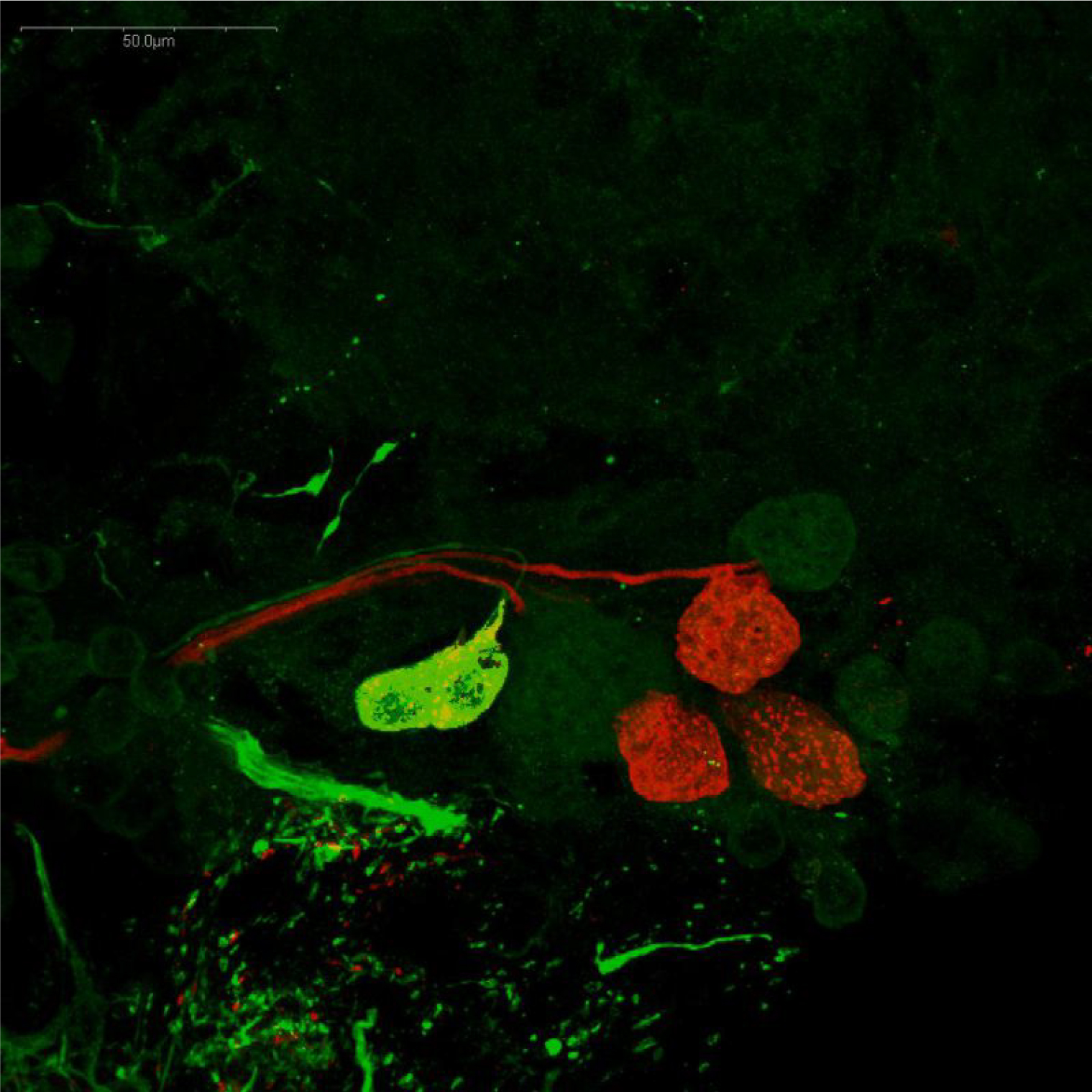 ザリガニ眼柄のドーパミン作動性およびセロトニン作動性ニューロンの免疫蛍光染色像