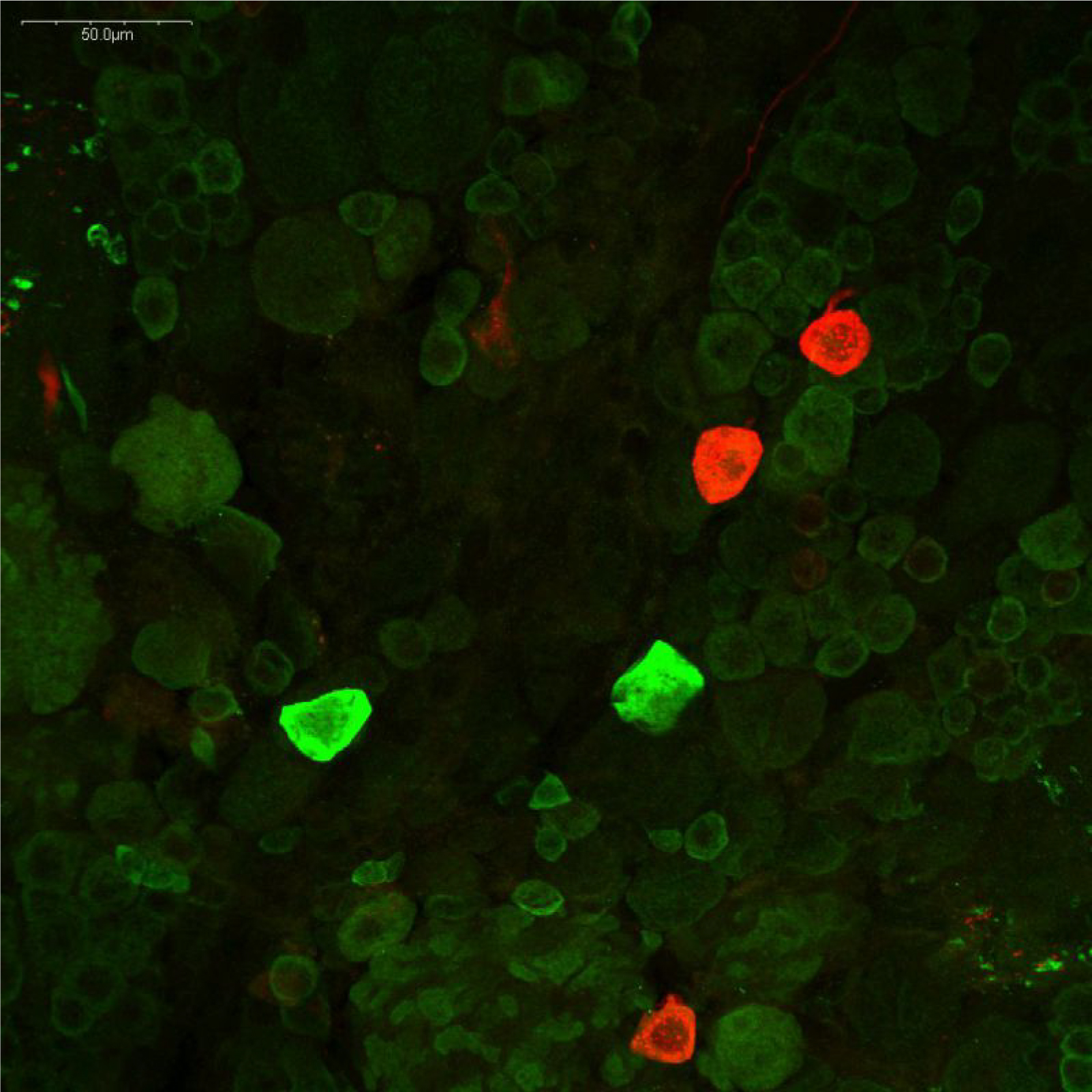ザリガニ脳のドーパミン作動性およびセロトニン作動性ニューロンの免疫蛍光染色像