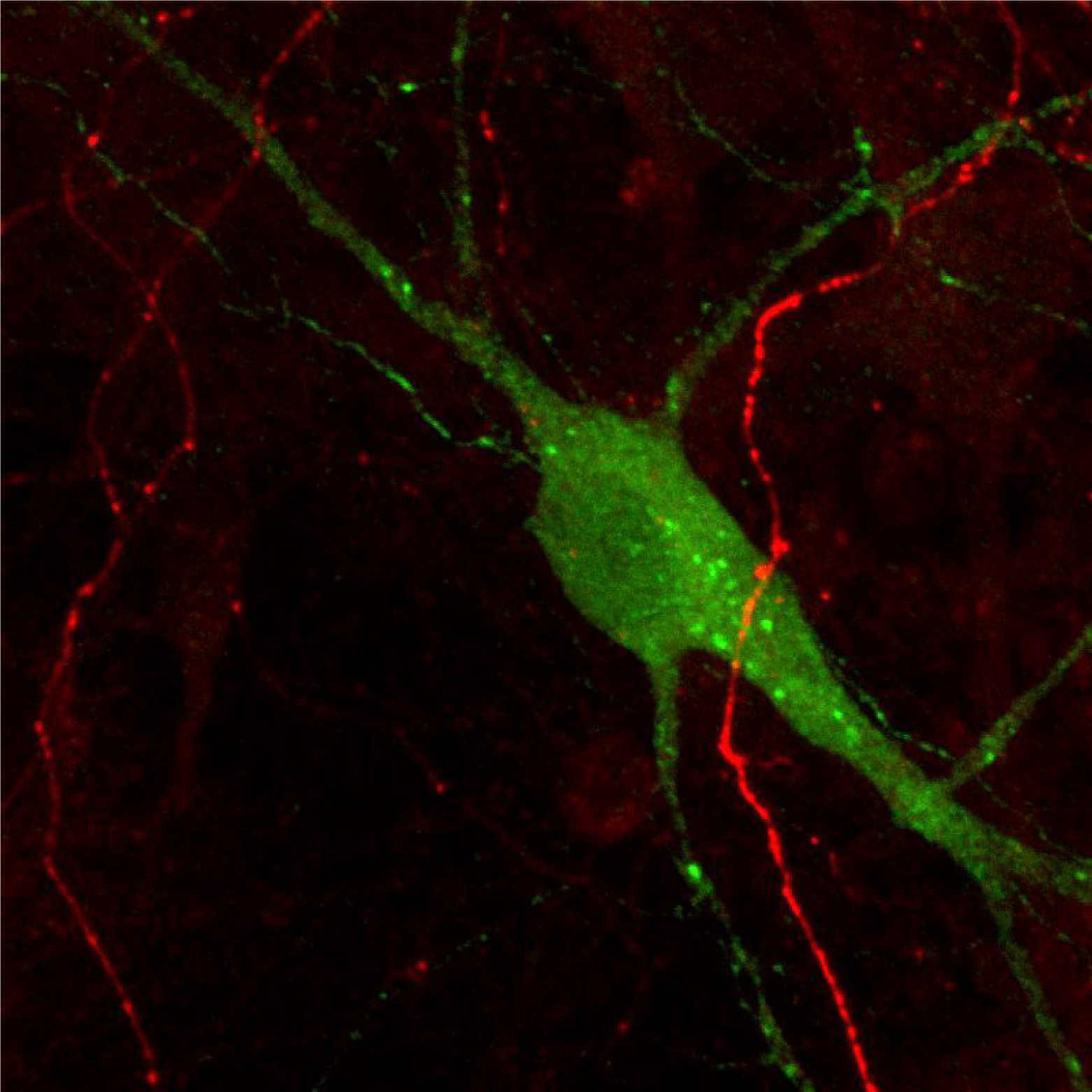 マウス初代培養中脳ニューロンのドーパミン作動性およびセロトニン作動性ニューロンの免疫蛍光染色像