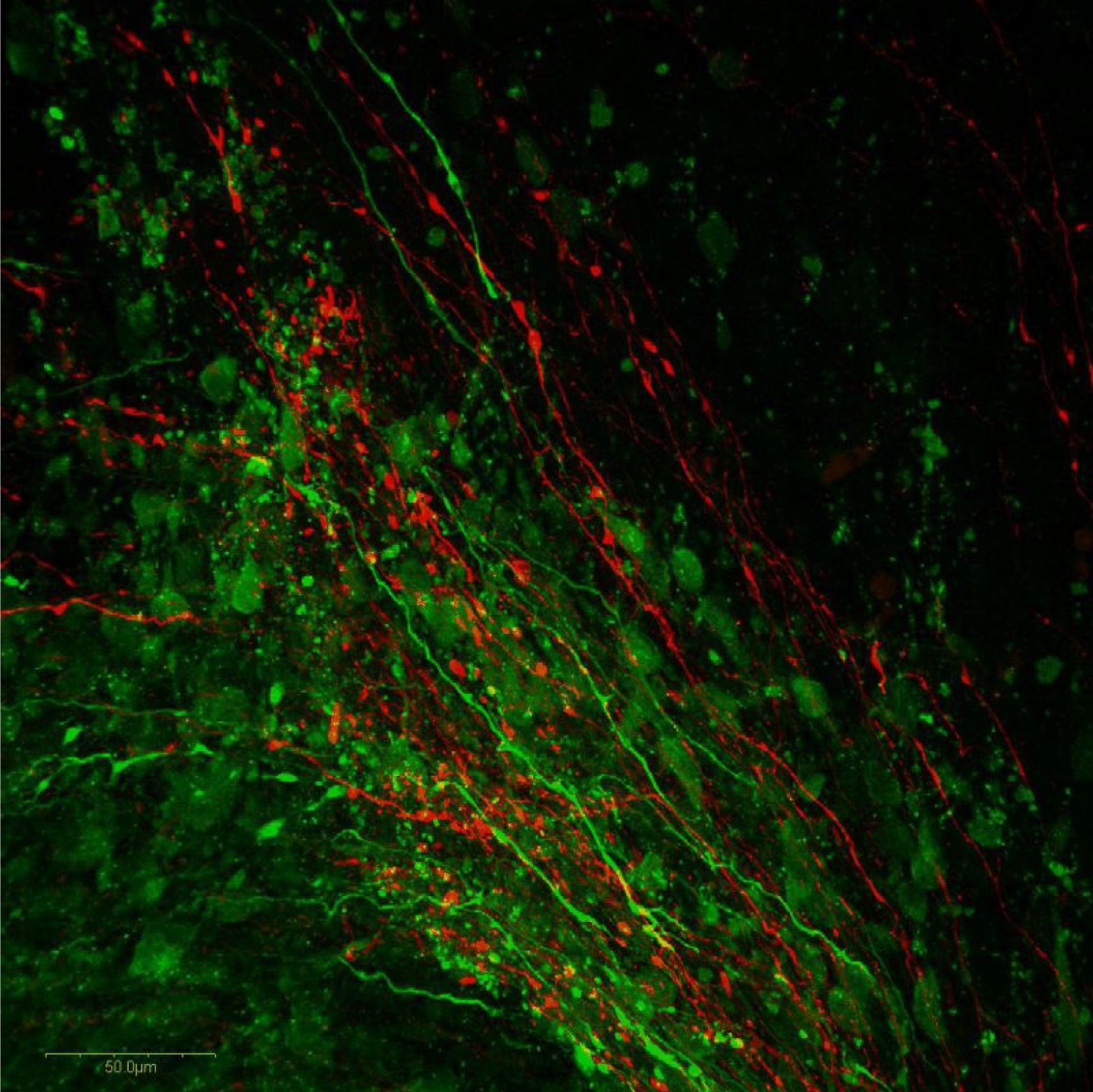 マウスE13.5胚の中枢神経におけるドーパミン作動性およびセロトニン作動性ニューロンの免疫蛍光染色像