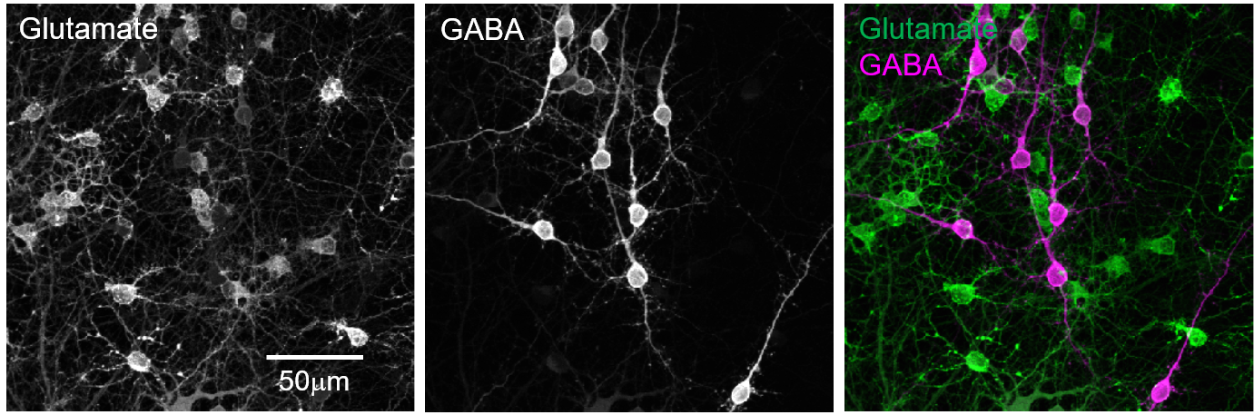 初代培養線条体神経細胞のグルタミン酸とGABA の共染色画像