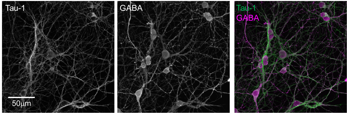 初代培養線条体神経細胞のGABA と軸索マーカーTau-1 の共染色画像