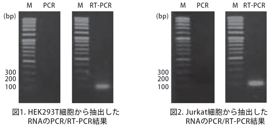 培養細胞からのRNA抽出およびRT-PCRによる検出結果