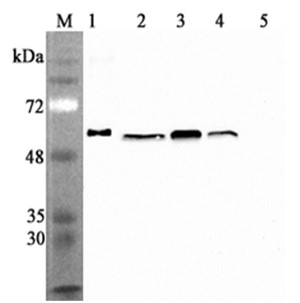 抗Calreticulin抗体（#AG-20A-0079）を用いたウエスタンブロッティング像