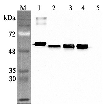 抗Calreticulin抗体（#AG-25A-0094）を用いたウエスタンブロッティング像