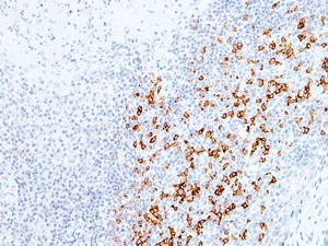 ホルマリン固定・パラフィン包埋（FFPE）ヒト扁桃腺組織における抗ヒトPD-1抗体（#AG-20B-6020）を用いた免疫組織染色（IHC）像