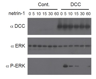 Apoptosis (アポトーシス)研究に有用なネトリン1 Netrin-1 (human):Fc (human) (rec.)の使用例1