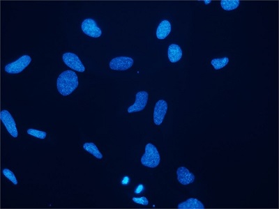 DAPIによる核の蛍光染色例