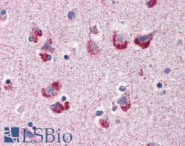 試料：ホルマリン固定／パラフィン包埋ヒト大脳皮質 抗体：抗MAG抗体（#LS-B2213-50）